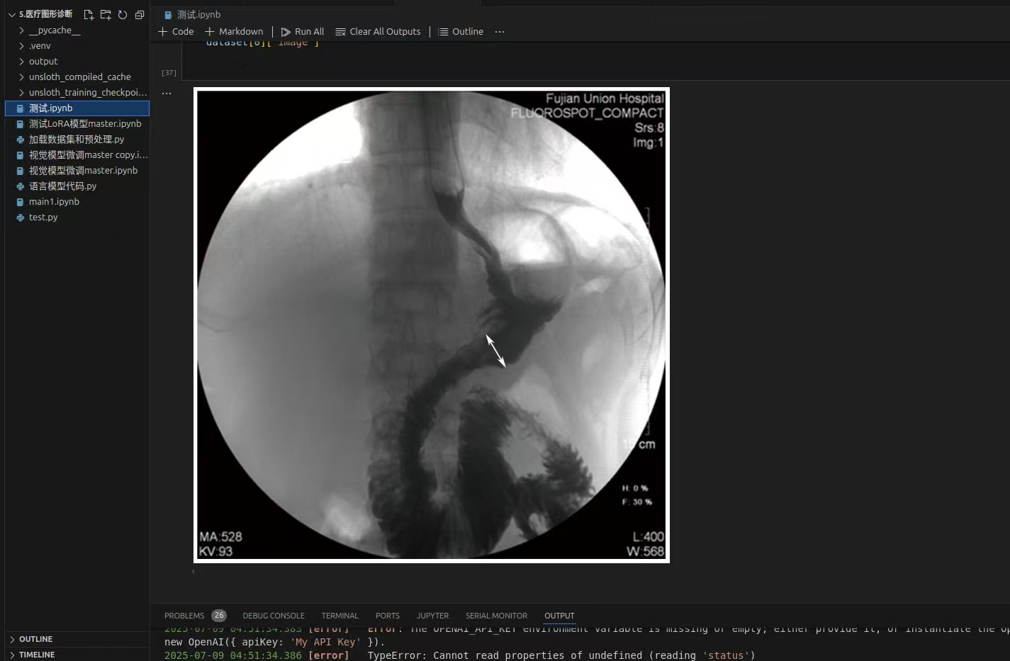 ai大模型医疗图像识别